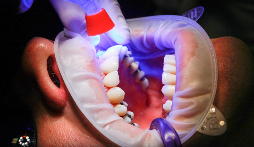 Dental health