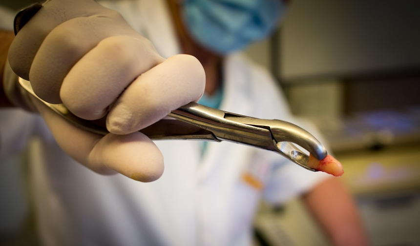 Extracted tooth