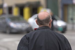 scalp